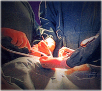 Diagnostics, Bone Surgery, Ophthalmology, Tracheotomy, Vaccination and Puncture, General Instruments, ENT Surgery, Cardiovascular,  Bone Surgery Instruments, Surgery Products, Gynecology Products, Cardio Surgical Instruments, Beauty Care Products, Dental Products, Dental Surgical Products, General Instruments, Suture, Plaster, Diagnostics, Neurosurgery Instruments, Sialkot, Pakistan.